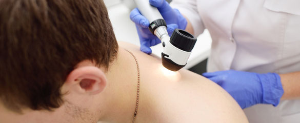 Δερματοσκόπηση σπίλων