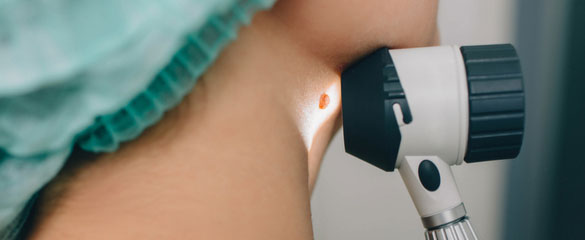 Δερματοσκόπηση